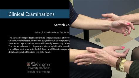 scratch collapse test|scratch collapse test carpal tunnel.